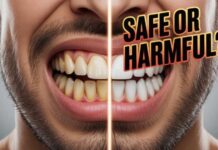 Teeth Whitening Powder – Safe or Harmful