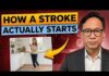 Sudden Stroke? DO THIS NOW! What a Stroke Looks Like the Day Before It Hits — Know This to Protect Yourself