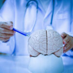 Brain Fog EPIDEMIC: What’s Behind This Surge? A doctor pointing at a brain model with a pen