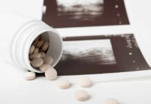 Spilled pills beside medical imaging prints