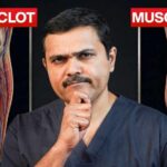 Don't Ignore These 10 LEG PAIN Signs That Could Save Your Life