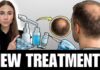 Hair Loss Myths EXPOSED — One Fix Wins New Hair Loss Treatments in 2026 | Dermatologist Explains What Actually Works