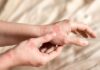 Skin Cancer: How to Spot Silent Warning Signs Close-up of a person's hands showing skin irritation and redness