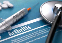 Simple Habits That Slash Arthritis Risk Syringe and stethoscope on arthritis document