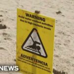 Bacteria shuts down beaches coast to coast in the U.S.