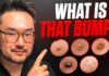 Common Skin Growths Explained One By One Lumps and Bumps On Your Skin | Dr. Danny Guo