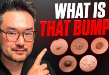 Lumps and Bumps On Your Skin | Dr. Danny Guo