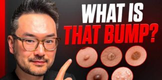 Lumps and Bumps On Your Skin | Dr. Danny Guo