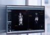 Advanced Prostate Cancer Isn’t What You Think Why Advanced Prostate Cancer is More Treatable Than Ever