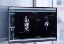 Why Advanced Prostate Cancer is More Treatable Than Ever