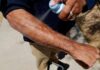 DIY Homemade Sunscreen? FDA Sounds Alarm! Mayo Clinic Minute - What type of sunscreen should you use?