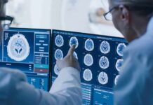Alzheimer’s Alarm: One Scan, Decade Forecast Doctors reviewing brain MRI scans on multiple monitors
