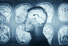 Hidden Protein Spike Hints Alzheimer’s Trouble Decades Early MRI scans of the brain displayed alongside a silhouette of a human head