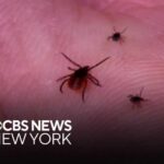 4th case of rabbit fever detected in Suffolk County