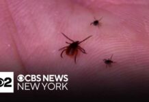 4th case of rabbit fever detected in Suffolk County