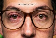 Allergy Eyes vs Dry Eye: How to Choose the Right Eye Drops (and Avoid the Wrong Ones)
