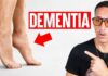 5 Physical Signs Linked to Alzheimer's & Dementia