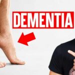 5 Physical Signs Linked to Alzheimer's & Dementia
