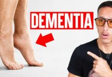 5 Physical Signs Linked To Dementia 5 Physical Signs Linked to Alzheimer's & Dementia