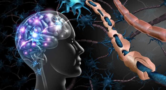 Human brain and damaged myelin sheath illustration