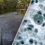 Brain-eating amoeba leaves one child dead, teen in critical condition