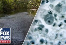 Brain-eating amoeba leaves one child dead, teen in critical condition