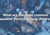 Shocking ER Trend: Kids Burned At Home Burn Safety for Kids Q&A