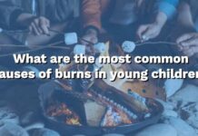 Burn Safety for Kids Q&A