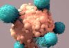 Mayo Clinic Minute - New approaches bring progress in treating multiple myeloma