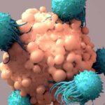 Mayo Clinic Minute - New approaches bring progress in treating multiple myeloma