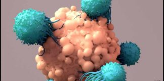 Mayo Clinic Minute - New approaches bring progress in treating multiple myeloma