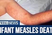 Infant died of measles in growing outbreak
