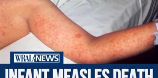 Infant died of measles in growing outbreak