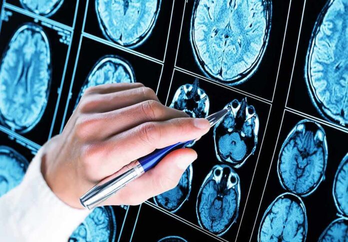 shutterstock_1176078337-1 Hand with pen pointing at brain MRI scans