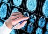 Stanford Shocker: Two Brains, One Skull? Hand with pen pointing at brain MRI scans
