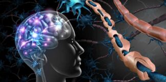 Human brain and damaged myelin sheath illustration