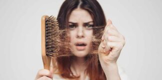 Woman holding a hairbrush with clumps of hair